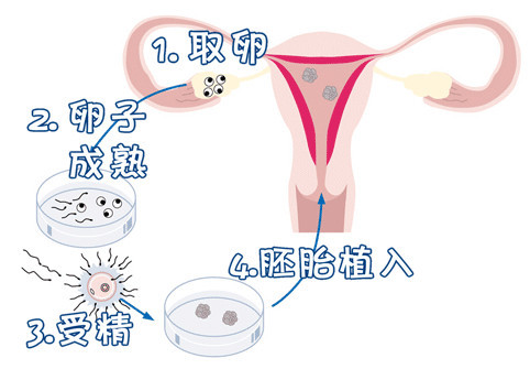 慈安中西医结合试管中心